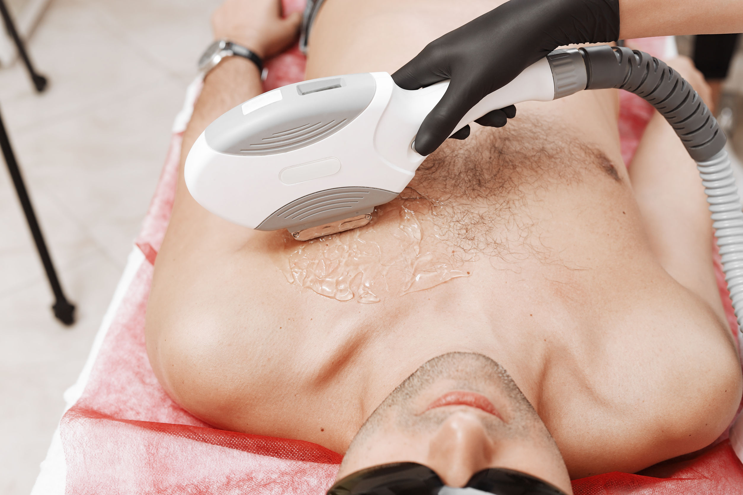 IPL offers permament hair reduction and uses a larger wand and cooling gel.