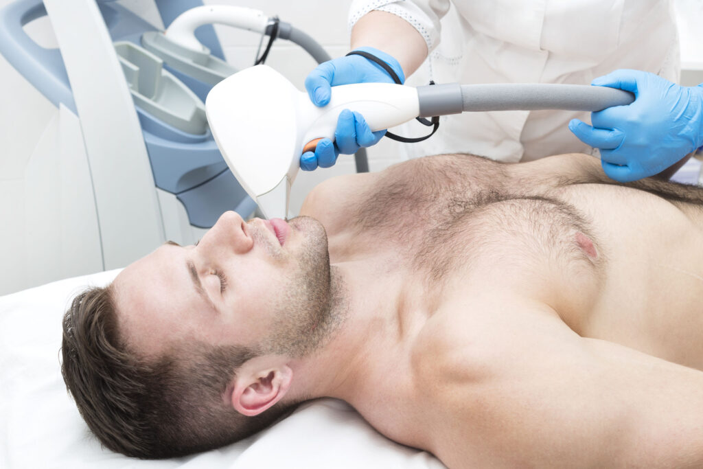 Is laser hair removal permanent?