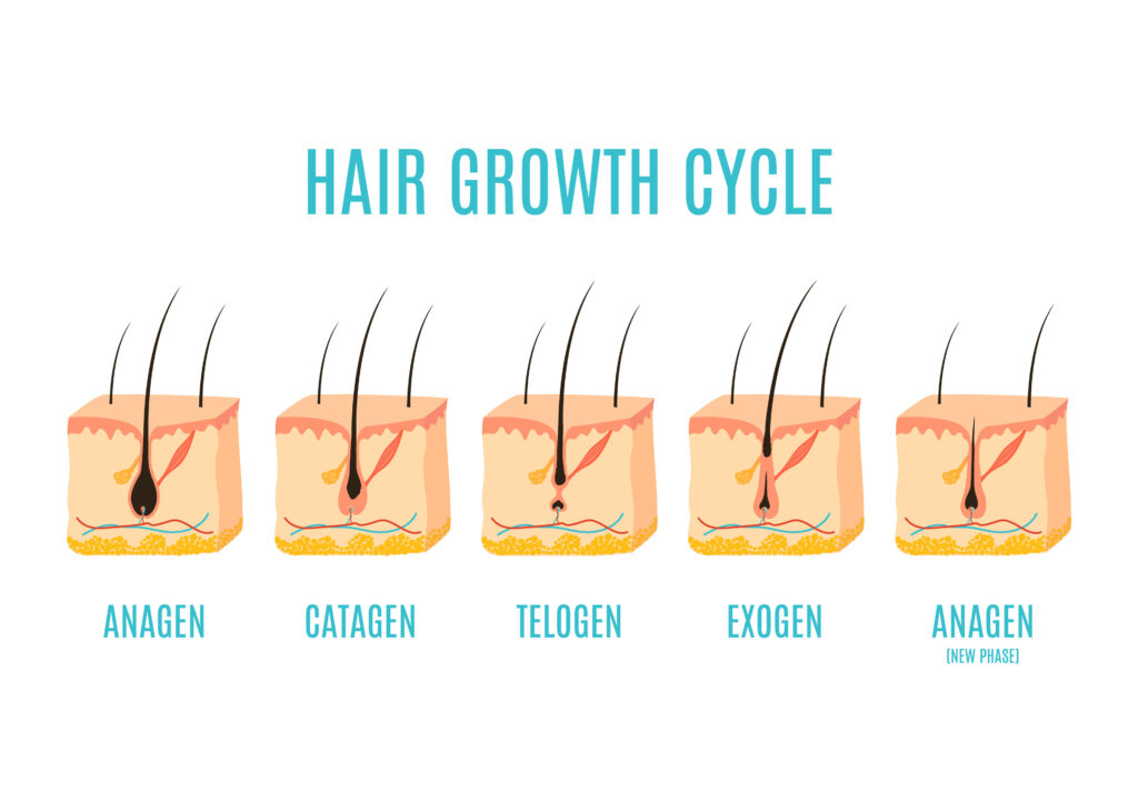 What is permanent hair removal?