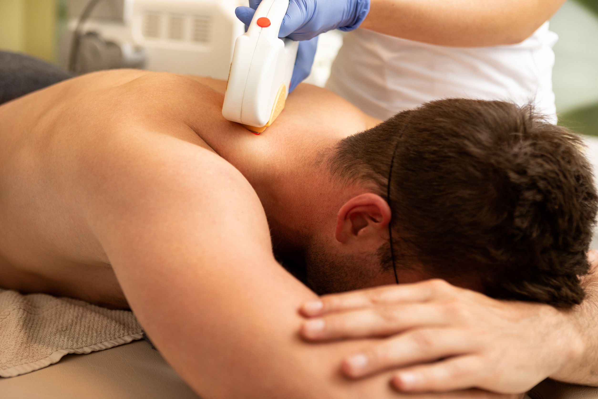 Laser hair removal on the shoulders and back is a popular option for men.