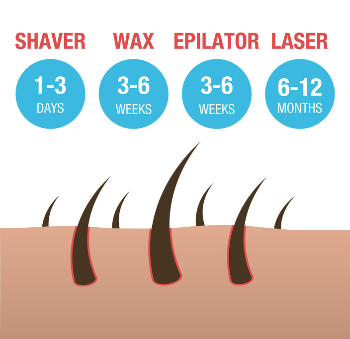 Comparison of the types of hair removal laser, epilator, waxing and shaving for the bikini area.