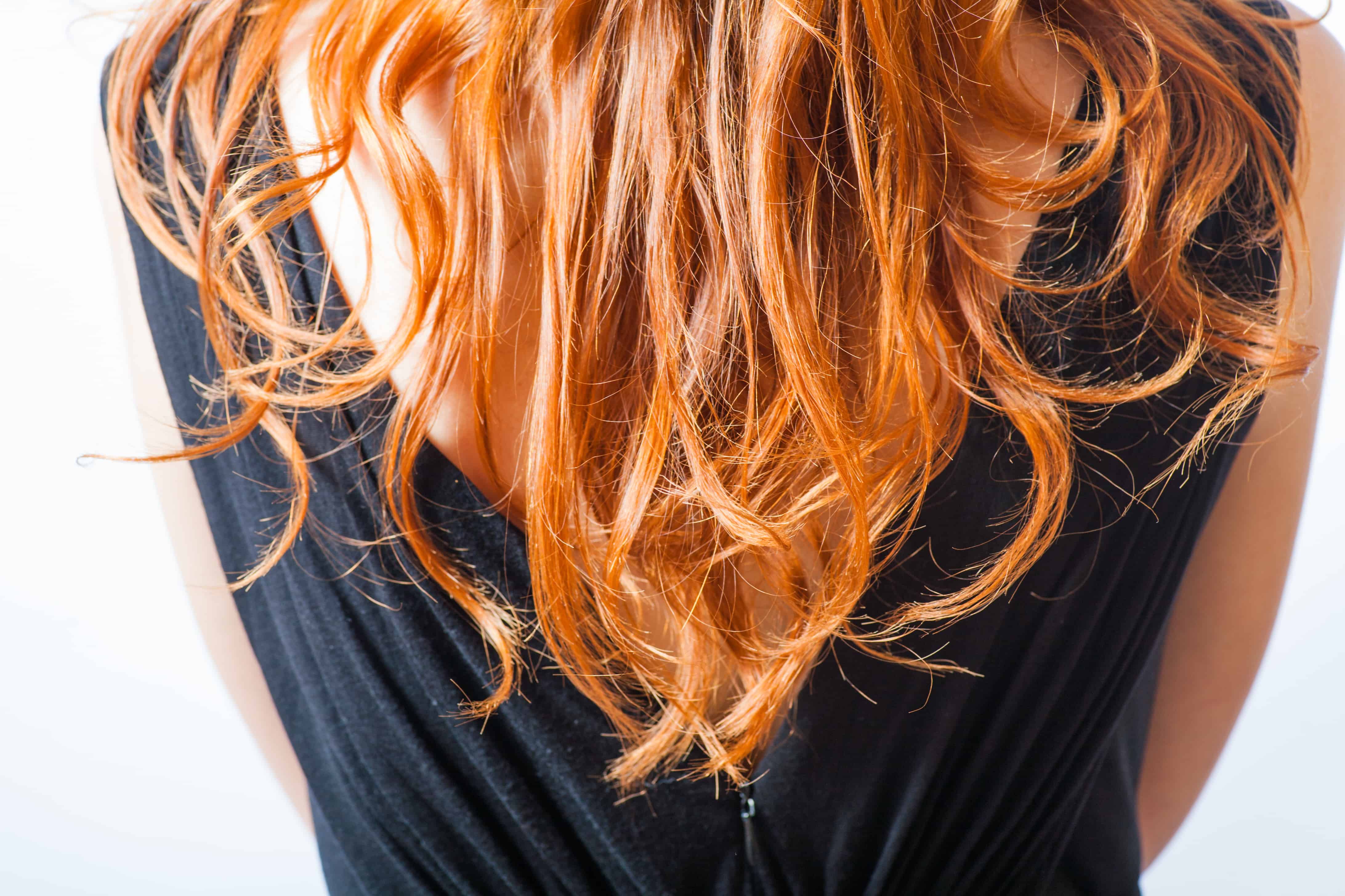 Does Laser Hair Removal Work For Red Hair?